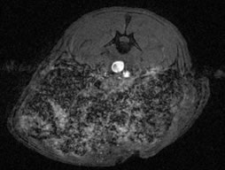 Rat model of aortic aneurism