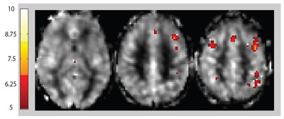 research topics for mri