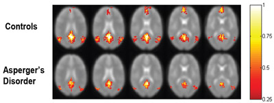 research topics for mri