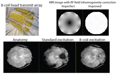 research topics for mri