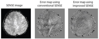 research topics for mri